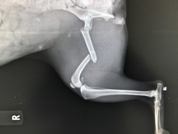 ortopedia fraktury 1