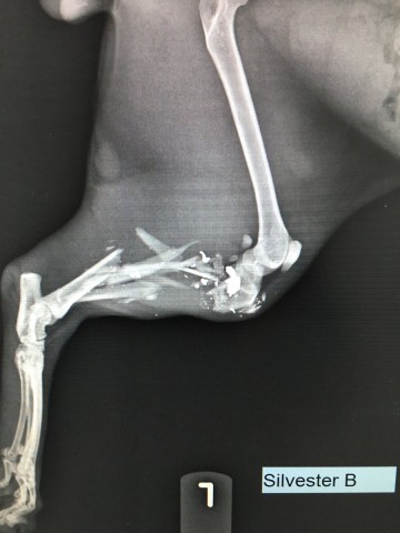 ortopedia fraktury 5