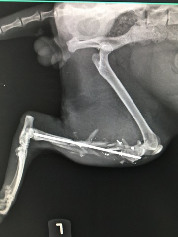 ortopedia fraktury 6