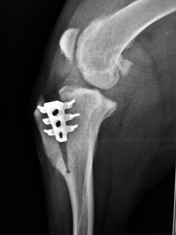 ortopedia operacia kolena 1
